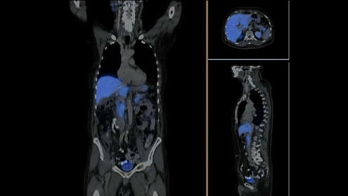 Astonish TF | Philips