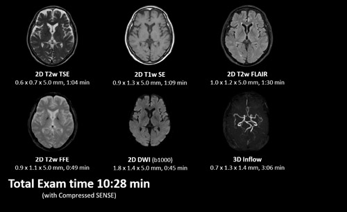 Examination Time Compressed Sense
