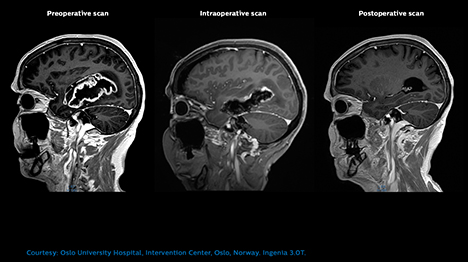 magnetic resonance OR WEB 06 Intraoperative resized